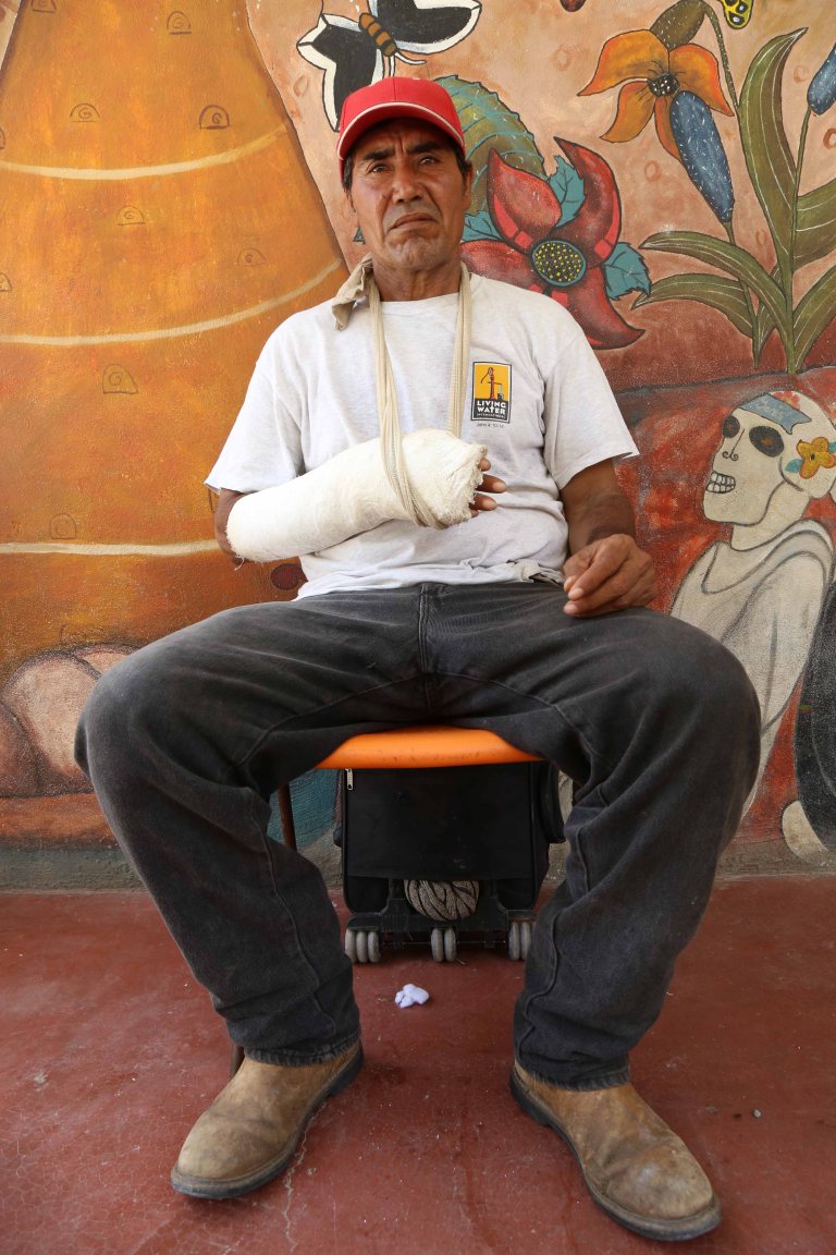 BrokenArm