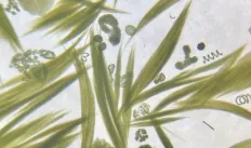 Cyanobacteria under micrscope